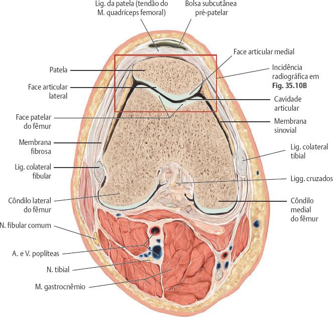 Classificação dos ossos Ossos sesamoides (p. ex., patela) desenvolvem-se em certos tendões.