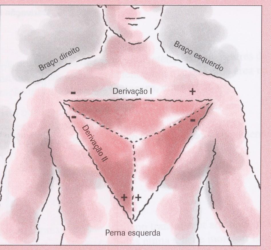 Interpretação do eletrocardiograma 6.