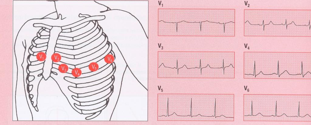 Interpretação do eletrocardiograma 6.