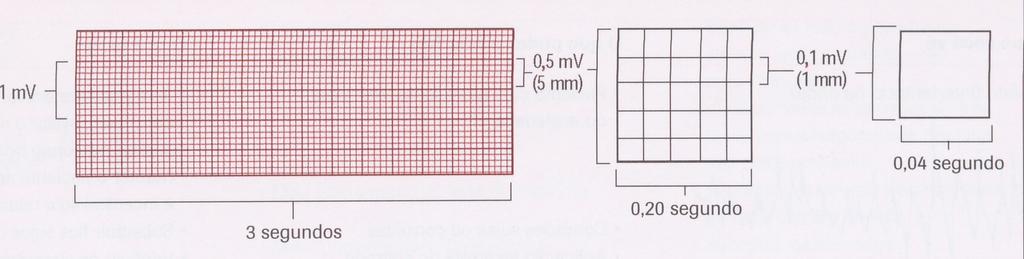 Interpretação do