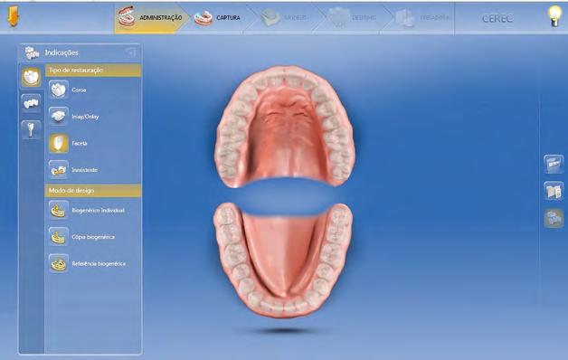 003 WORKFLOW NO CEREC FSE DE DMINISTRÇÃO Na etapa inicial do software, após cadastro do paciente, deve ser selecionado o tipo de restauração, o modo de design, o material de escolha para confecção da