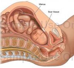 Sinapses elétricas musculatura endometrial