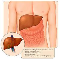 Definição: Doença inflamatória do