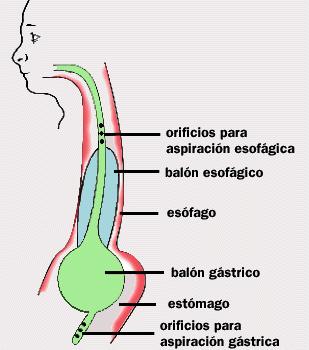 Sonda