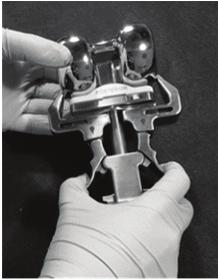 Em seguida, pressione os gatilhos e remova o implante (observe as Figuras 23, 24 e 25)