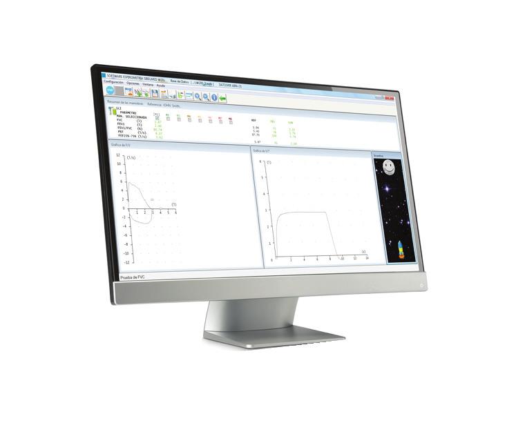 controlo de qualidade da espirometria Software W20s incluído Impressora interna SpO 2,