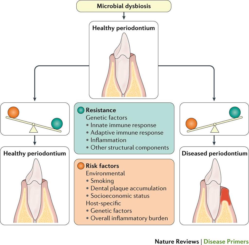 Disbiose microbiana Saúde periodontal Suscetibilidade às doenças periodontais A doença periodontal é multifatorial Condições que alteram o quadro inflamatório Saúde periodontal Resistência-