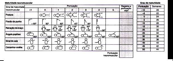 27 Quando a idade gestacional não pode ser claramente identificada, a ultra-sonografia obstétrica pode ser muito útil e bastante acurada, se realizada antes de 20 semanas de IG