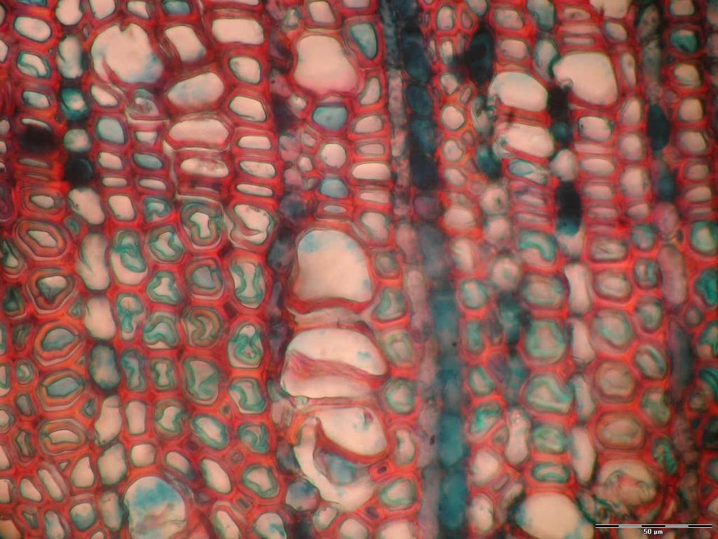 Detalhes anatômicos da madeira de