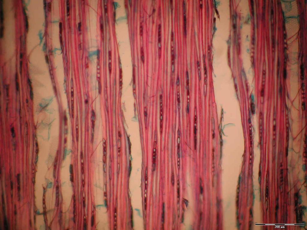 heterogêneos e pontoações raio-vasculares nas