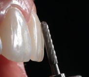 ORTODÔNTICAS ORTODÔNTICAS As brocas Ortodônticas Angelus Prima foram desenvolvidas para remoção de adesivos sem danificar o esmalte dental.