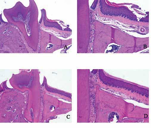 73 FIGURA 12 (A a D) Fotomicrografia da região do primeiro molar superior esquerdo dos animais do