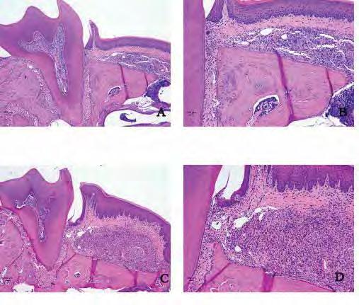 75 FIGURA 13 (A a D) Fotomicrografia da região do primeiro molar superior esquerdo dos animais do grupo injeção de