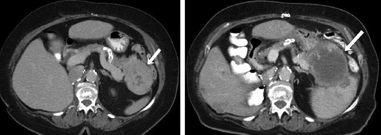 Morphology, Attenuation, Size and