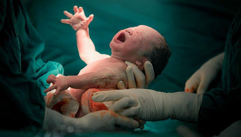 Período Fetal No fim do nono mês, cerca de 38 a 40 semanas de gestação, o feto com comprimento