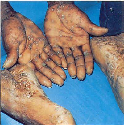 Lesões na pele