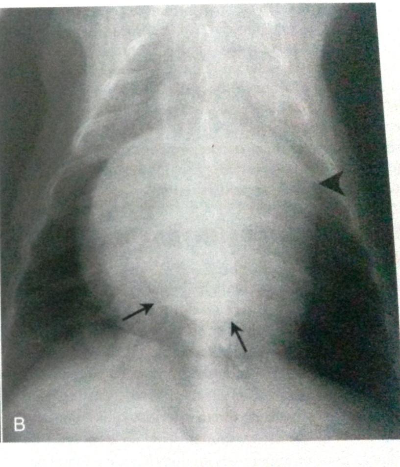 39 As radiografias cardíacas são importantes para avaliar o tamanho e o formato do coração, vasos pulmonares e parênquima pulmonar.