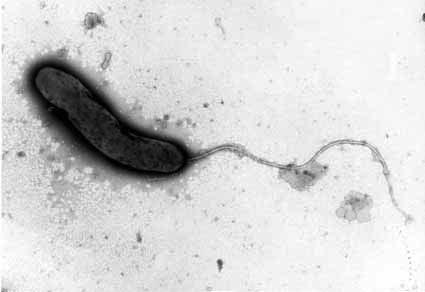 Vibrio cholerae - CÓLERA V.