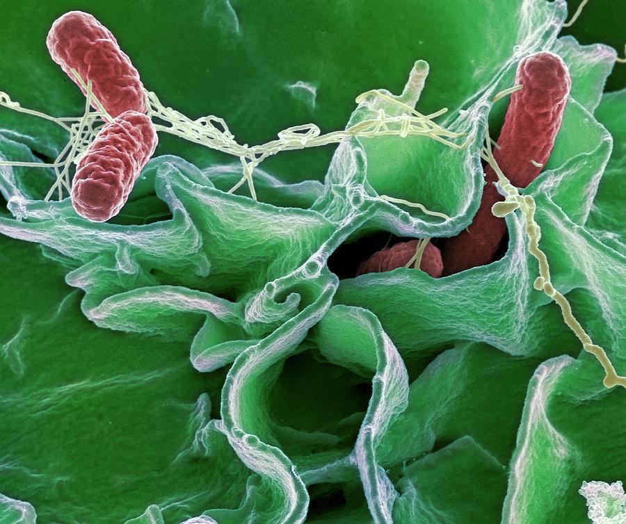intestino dos seres humanos e animais portadores; Bacilos Gram