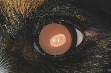 (o que auxilia no diagnóstico diferencial de distrofia de córnea). Deposição de cálcio ao longo da fissura palpebral é denominada ceratopatia em banda (Plummer et al., 2007).