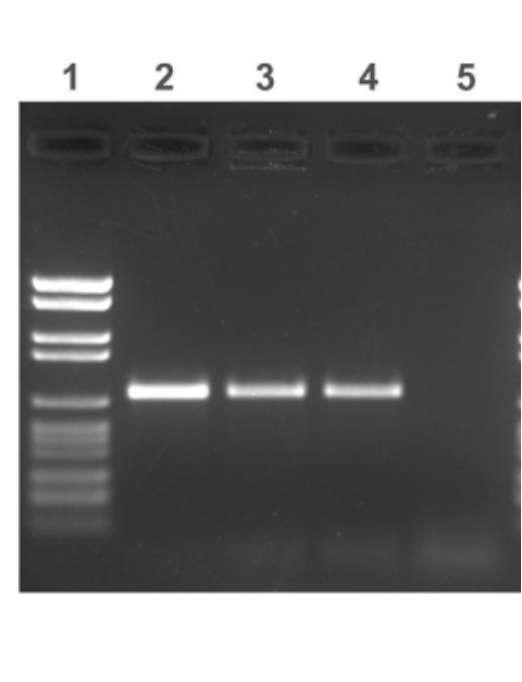 - Resultado da PCR Poço 5 Controle