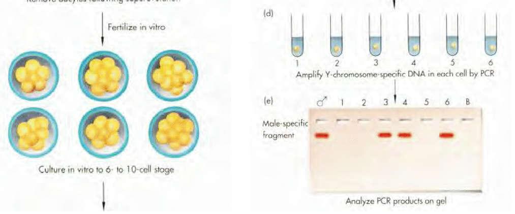 Determinação do sexo em células pré-natais 1. Óvulos fertilizados in vitro 2.