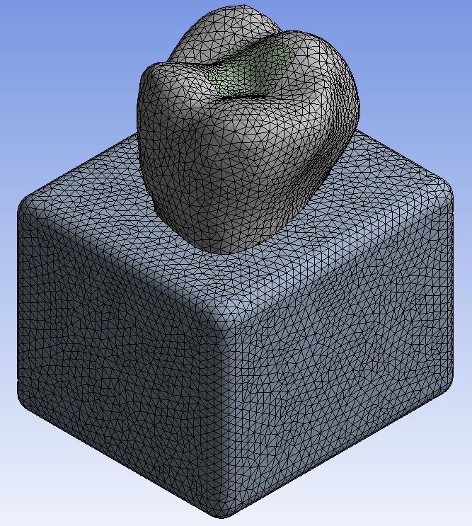 Geometria Hex Dominant Tetrahedrons Ordem da função de interpolação do elemento (SOLID85) (SOLID86/ SOLID87) (SOLID85) (SOLID87) Deslocamento [mm] c Ponto Ponto 2 Modelo 6,0867 3,7778 7,506 6,2883