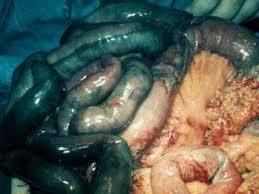 Intestinos LIVOR