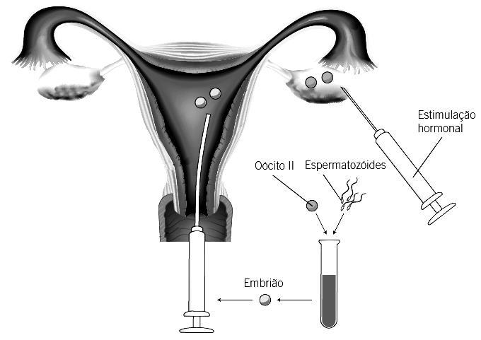 7.3. Qual dos seguintes procedimentos não é correto na utilização de um preservativo masculino: a) Colocar apenas com o pénis em ereção b) Utilizar um lubrificante como a vaselina c) Remover logo