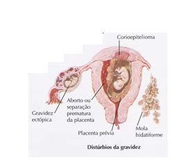 Causas associadas à gravidez - sangramento de implantação - DPP/PP - abortamento - gravidez ectópica - doença trofoblástica gestacional -