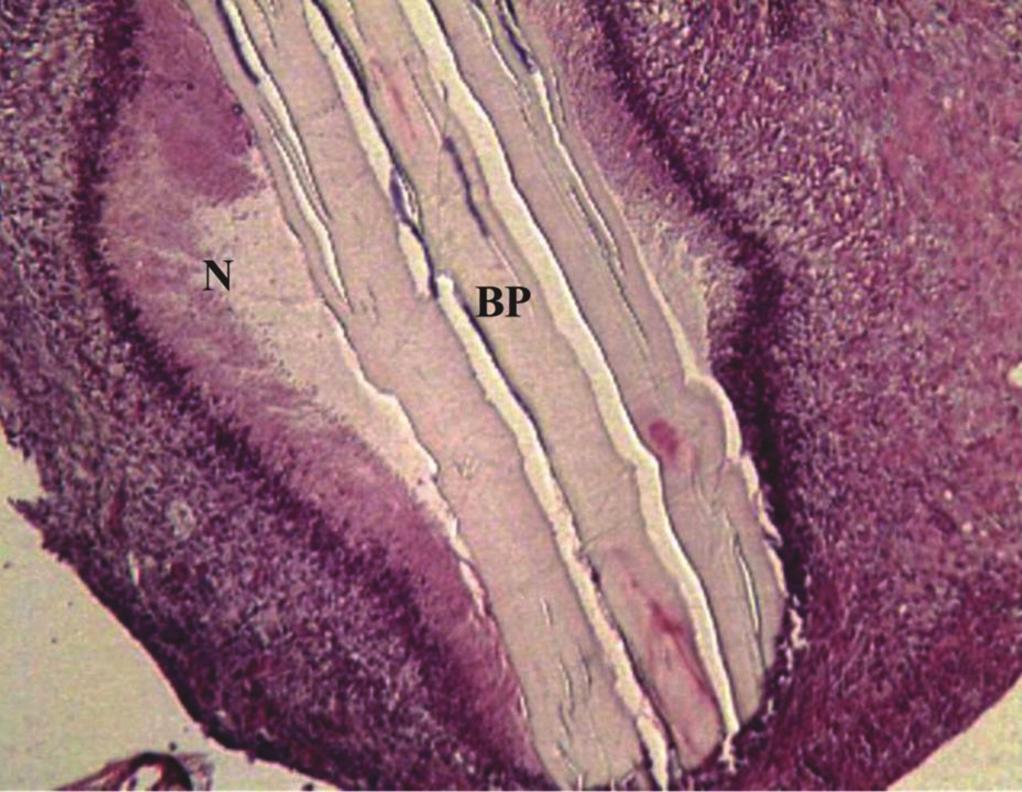 HE(aumento 40x). Houve um espessamento mais acentuado da mucosa, com deposição de colágeno observado na coloração PSR, em apenas duas orelhas, uma no tempo t1 e outra em t2.