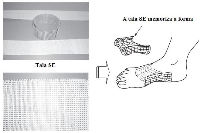 37 Tala superelástica para a recuperação de hálux valgo: Popularmente conhecido como joanete, o hálux valgo é um desvio lateral acentuado do primeiro pododáctilo, o hálux ou dedão do pé.
