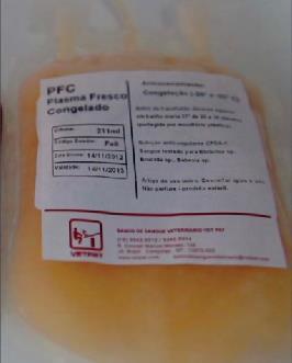 PLASMA FRESCO CONGELADO - (4 UNIDADES) 60,00 CADA Os hemocomponentes e suas indicações Sangue