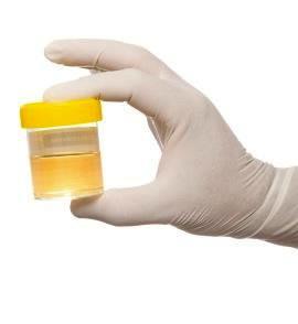 Introdução As infeções do trato urinário (ITU) são a segunda causa mais frequente de infeções na comunidade A Escherichia coli é responsável por 75 a 90% dos casos Elevadas taxas de