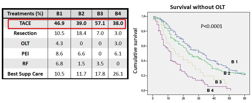 Subclassificação BCLC B influencia nos resultados do tratamento Sobrevida livre de transplante Análise retrospectiva