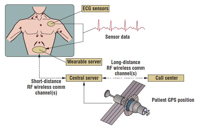 Aquisita sinais de ECG em tempo real de um paciente móvel ou em home care; Envia