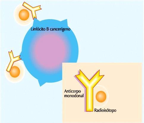 josé carlos Aplicações dos anticorpos monoclonais Radioterapia Alguns tratamentos recentes permitem sintetizar anticorpos contra células cancerosas contendo elementos