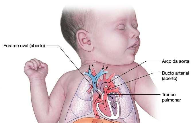 Outro desvio circulatório ocorre entre o tronco pulmonar e a