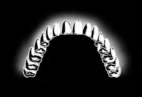 Superfície mesial é a face da coroa dentária voltada para a linha média. 3. Superfície palatina é a superfície da coroa dentária voltada para o vestíbulo da boca. 4.