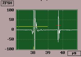 Representação A-Scan Representação A-scan: visualização da amplitude do sinal ultra-sónico recebido pelo transdutor em função