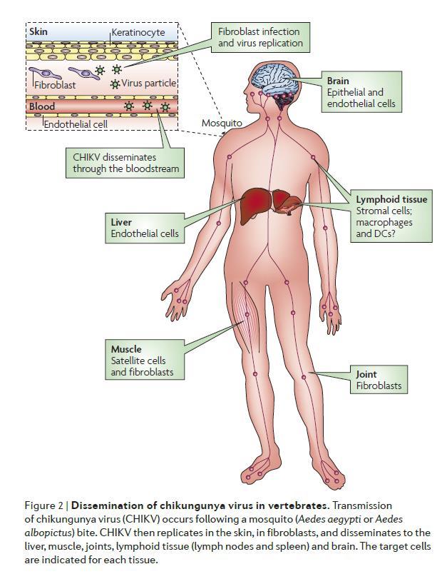 Quais são os sintomas? Febre Chikungunya Na fase crônica, o paciente ainda pode sentir dores nas articulações, depressão, cansaço e fraqueza.
