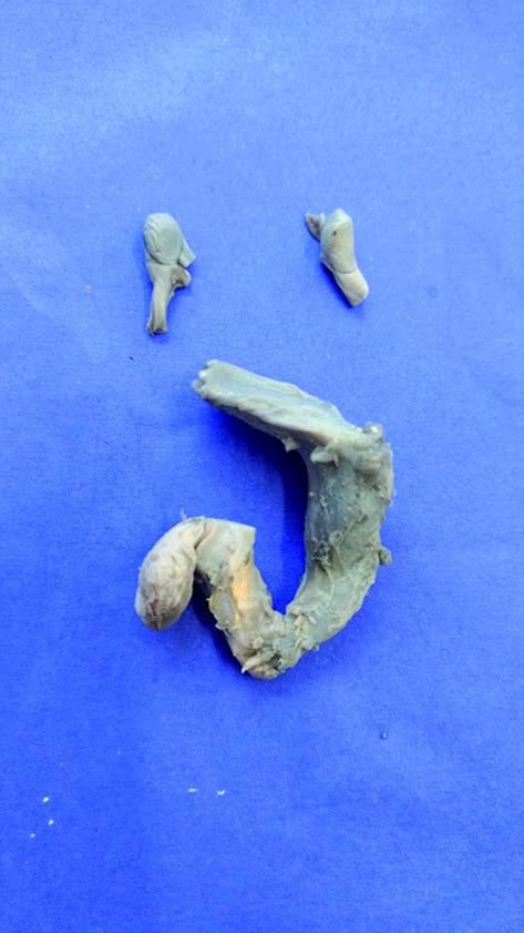27 Figura 9 - A figura evidencia o bloco do sistema urogenital retirado de um feto do grupo controle com 21 semanas pós-concepção
