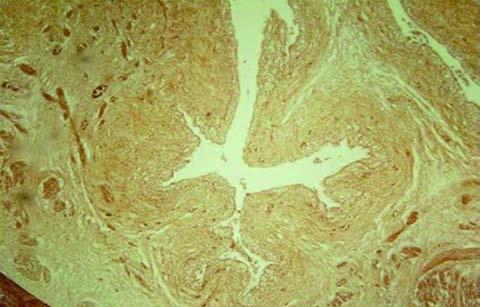 33 Figura 13 - a) Fotomicrografias da bexiga de um feto do grupo controle sem evidenciar a presença das fibras do sistema elástico. Feto do sexo masculino com 21 SPC.