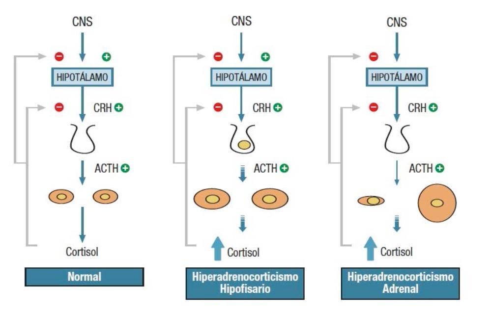 Hiperadrenocorticismo hipófise dependente Hiperadrenocorticismo adrenal