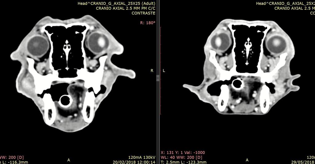 Radioterapia 27/02/2018 a 20/03/2018 16 x 3 Gy = 48 Gy