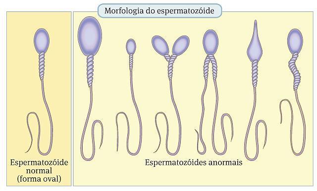 O número de espermatozóides tem diminuído significativamente ao longo das últimas décadas, com impactos
