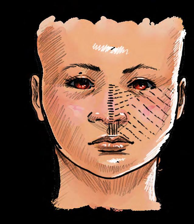 ANUÁRIO ODONTOPEDIATRIA CLÍNICA A formação da face tem início na 4ª semana, na qual o centro de desenvolvimento das estruturas faciais consiste em uma depressão frontal na superfície ectodérmica,