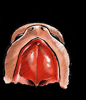 o palato primário e septo nasal, progredindo