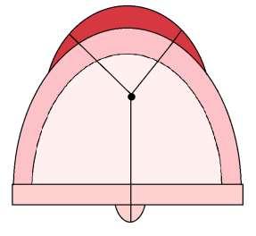 Grupo II: Fissura transforame incisivo envolve completamente os palatos primário e secundário, estendendo-se desde o lábio superior até o palato mole e úvula, pode ser uni ou bilateral; Grupo III:
