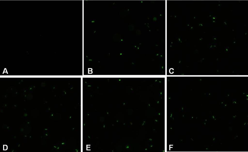 85 Figura 23: Microscopia óptica de fluorescência (MOF) de P. aeruginosa ATCC9027: (A) Controle (sem tratamento); (B) Tratada com gentamicina [10µg/mL]; (C) Tratada com extrato de H.